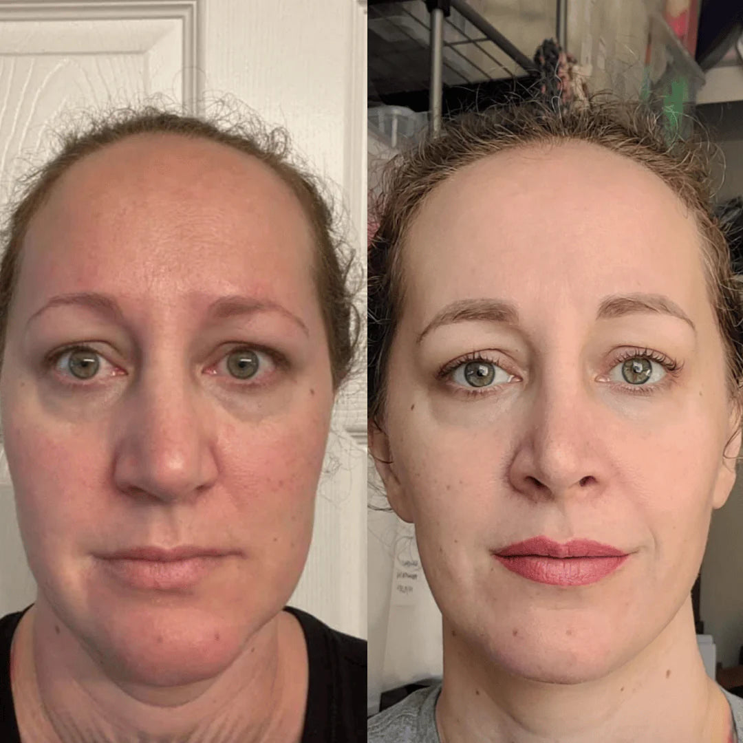 Fiorenza® Mascarilla Boost de Colágeno