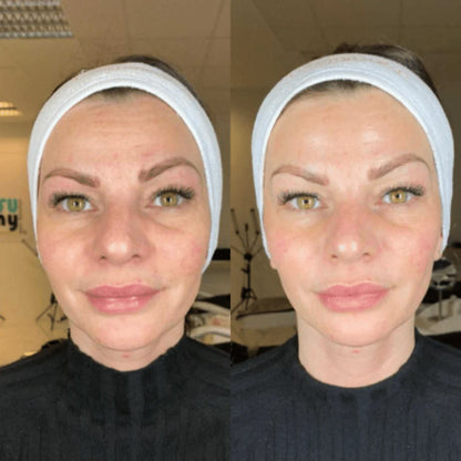 Fiorenza® Mascarilla Boost de Colágeno