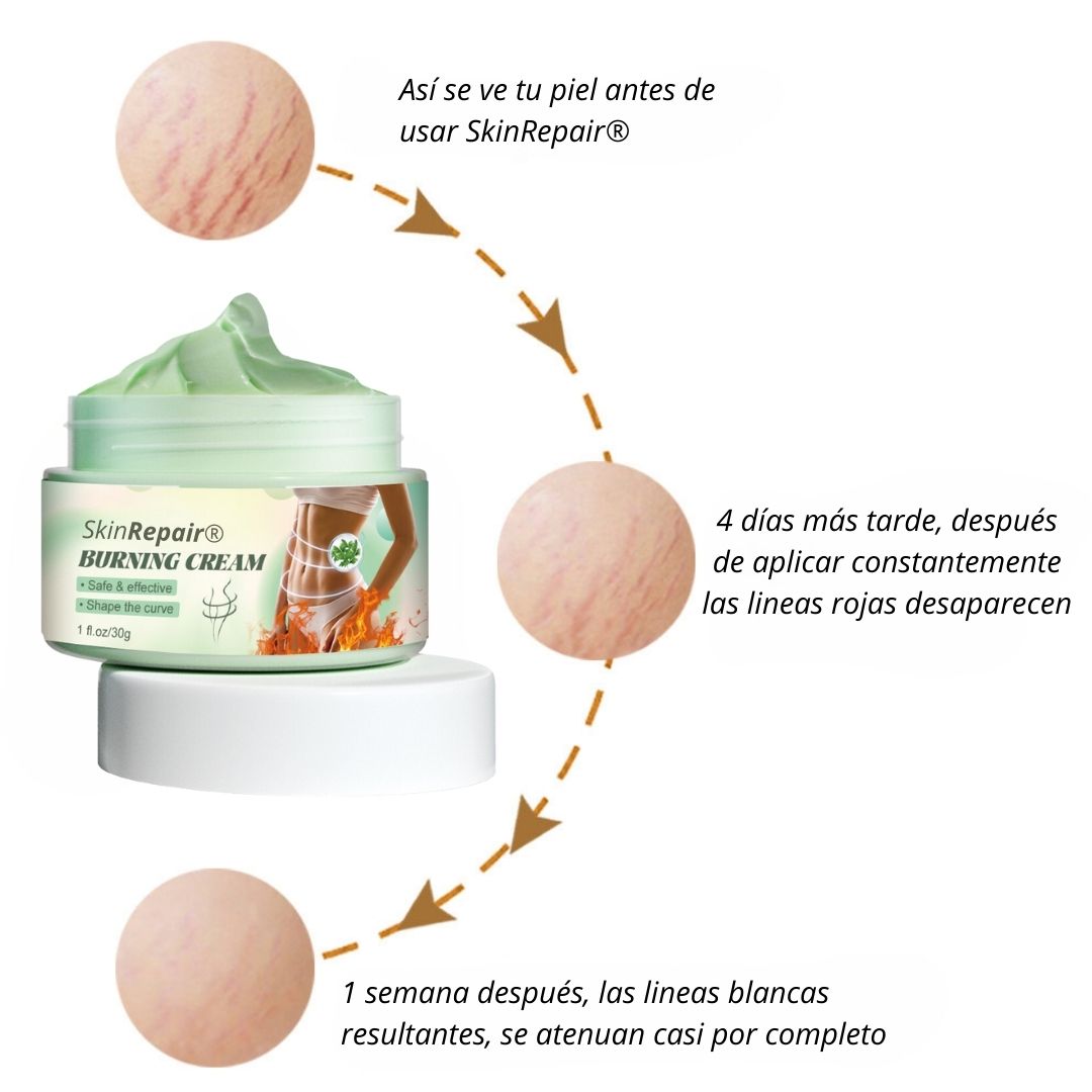 SKINREPAIR® CREMA CALIENTE REPARADORA